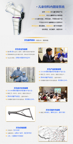 上海开为Carefix限制性加压钛板与锁定钛板 产品说明与价格指南